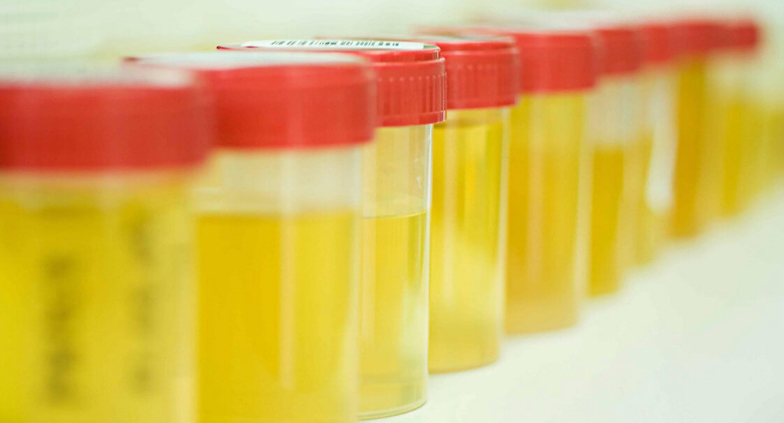 Директор ярославской школы-интерната, заставлявшая подростков пить мочу, пойдет под суд