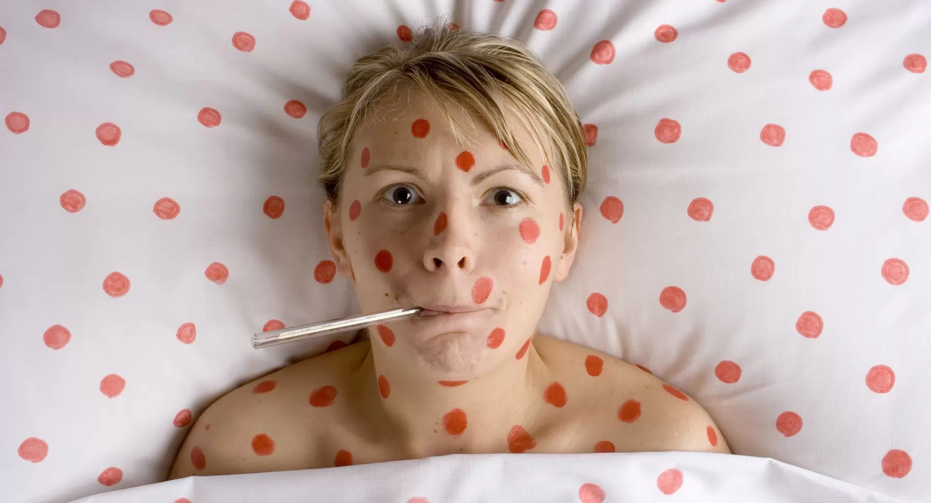 Что делать, чтобы не подхватить корь