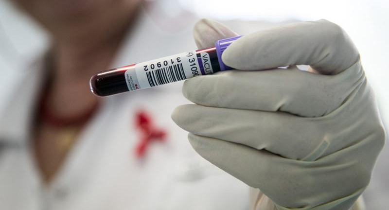 Число ВИЧ-инфицированных подростков выросло