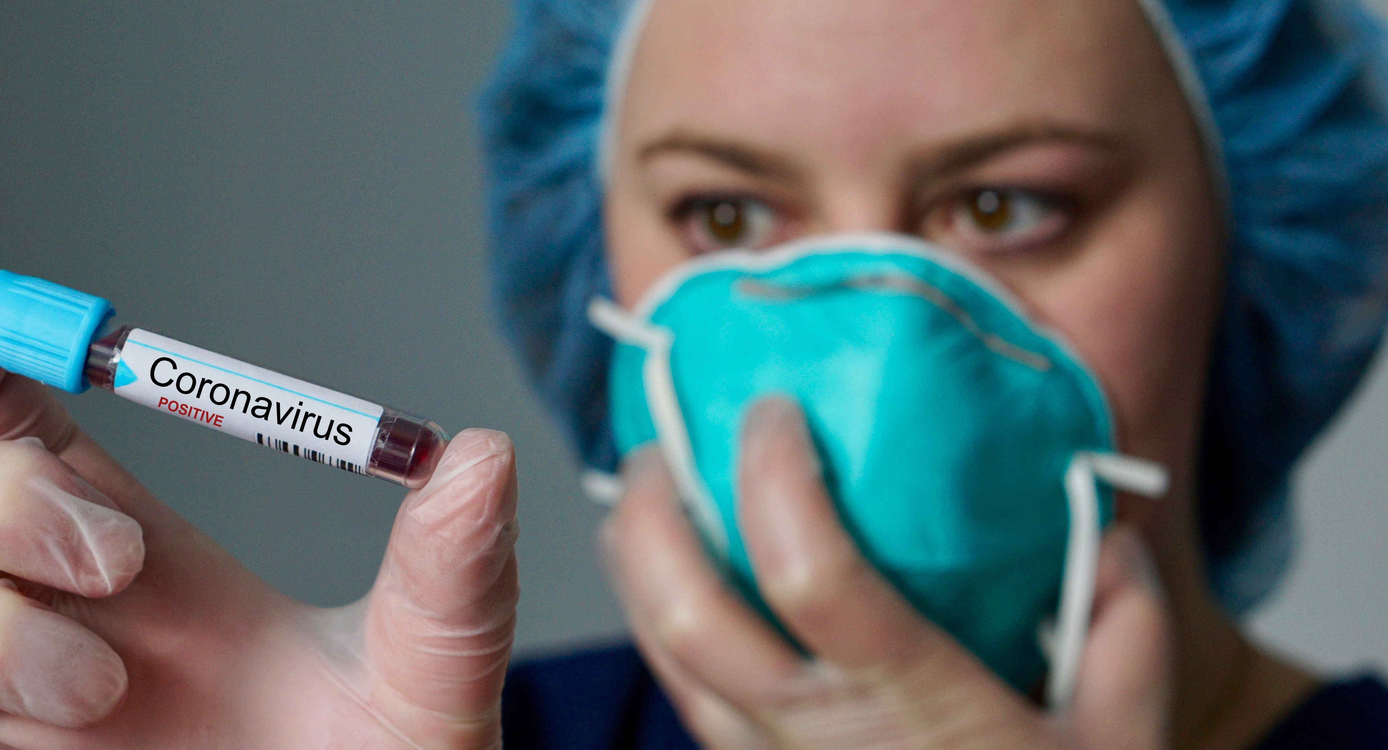 Подтверждена связь между группой крови и тяжестью COVID 