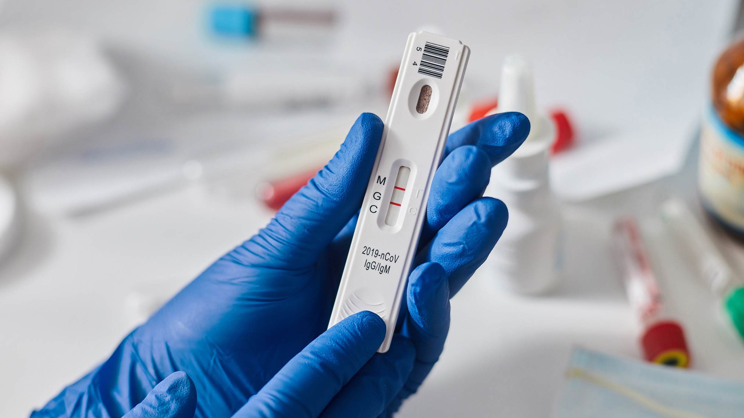 Немецких школьников обязали сдавать анализы на коронавирус