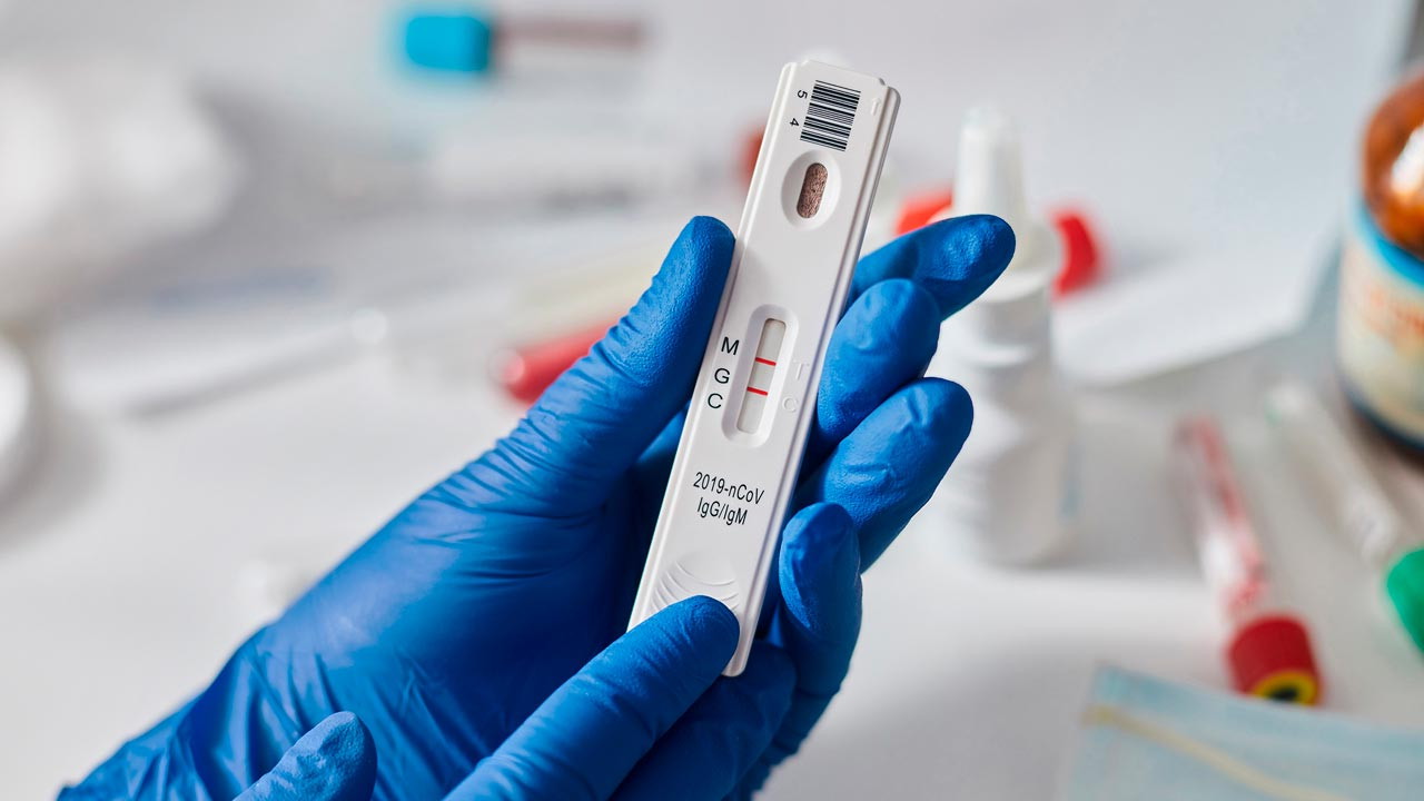 Родители написали открытое письмо против обязательного ПЦР-тестирования на COVID-19 в школах