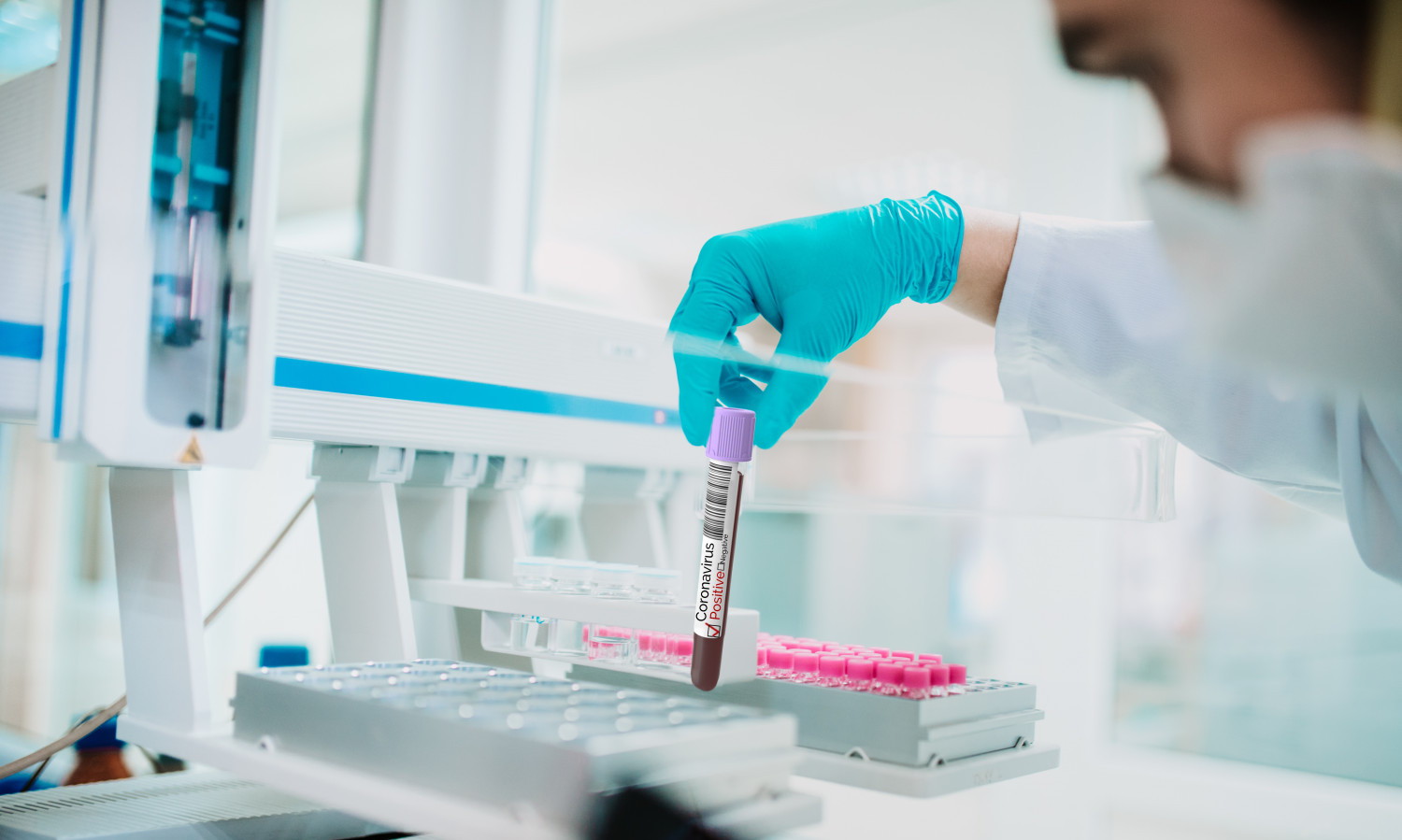 В России зарегистрировали новый тест на антитела у болевших COVID-19 бессимптомно