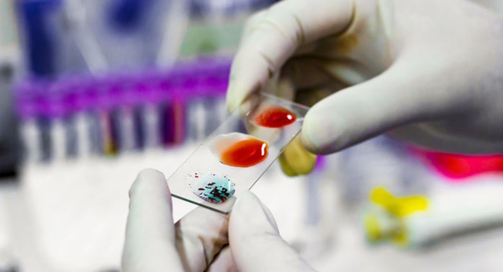 В Канаде создали универсальную донорскую кровь В Канаде создали универсальную донорскую кровь