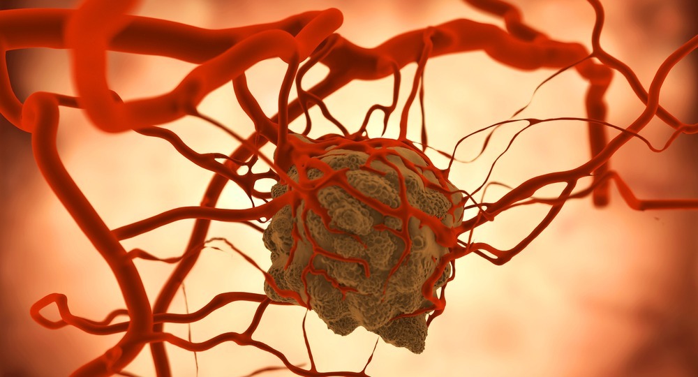 Росстат сообщил о рекордном числе больных раком детей Росстат сообщил о рекордном числе больных раком детей