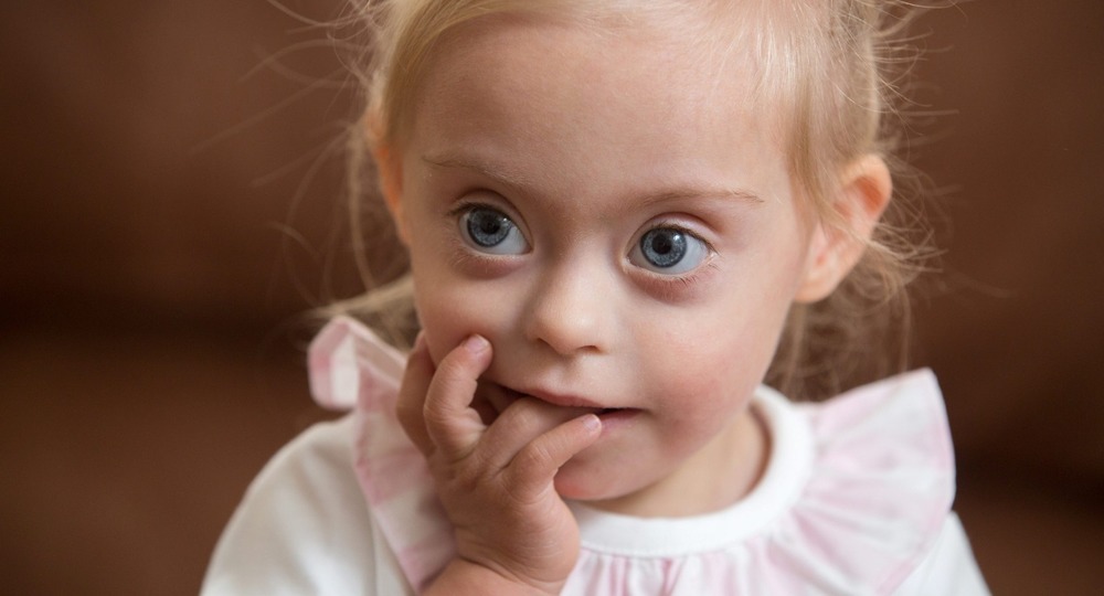 В России стало больше людей с синдромом Дауна В России стало больше людей с синдромом Дауна