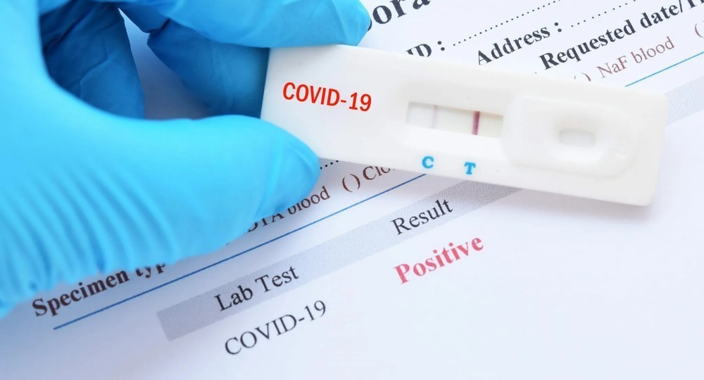 Срок действия ПЦР-теста сократят до 48 часов Срок действия ПЦР-теста сократят до 48 часов