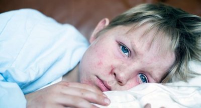 В двух московских школах ввели карантин по кори 