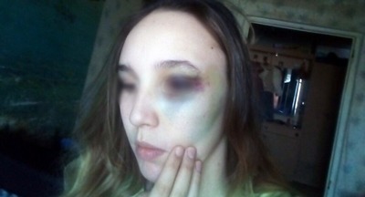В Подмосковье школьницы зверски избили сверстницу
