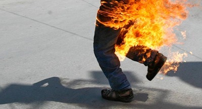 В Москве подросток облил горючей жидкостью и поджёг 11-летнего мальчика