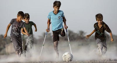 Иракский подросток Касим Алькадим, потерявший ногу во время теракта, прибыл в Москву