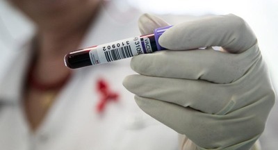 Число ВИЧ-инфицированных подростков выросло