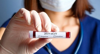 У госпитализированных в Москве граждан коронавирус не обнаружен