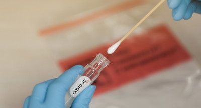 Власти Москвы объявили о начале массового тестирования на антитела к коронавирусу