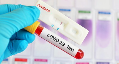 В 10 школах Москвы начнут бесплатно тестировать на коронавирус