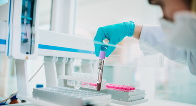 В России зарегистрировали новый тест на антитела у болевших COVID-19 бессимптомно