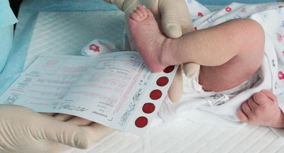 Всех новорожденных в РФ будут тестировать на 36 генетических заболеваний